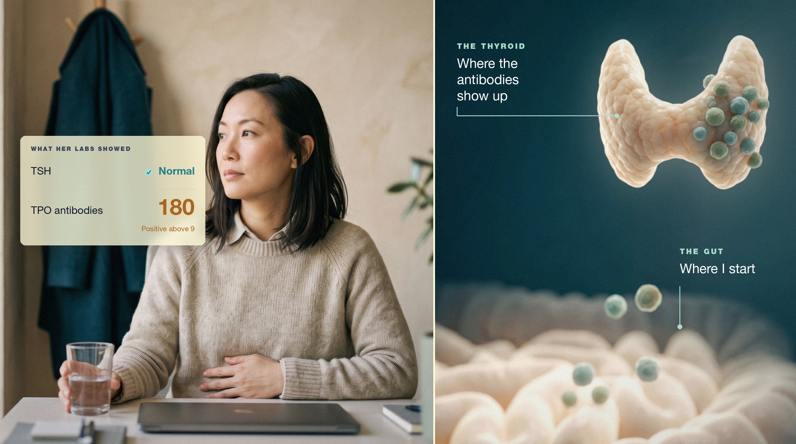 Two panels. Left: a woman in her late thirties sits at a desk with a glass of water, one hand resting on her stomach, beside a panel headed "What her labs showed": TSH normal, TPO antibodies 180, positive above 9. Right: an illustration of the thyroid with immune cells gathered on it, labeled "The thyroid: where the antibodies show up", above the gut with immune cells rising from it, labeled "The gut: where I start".
